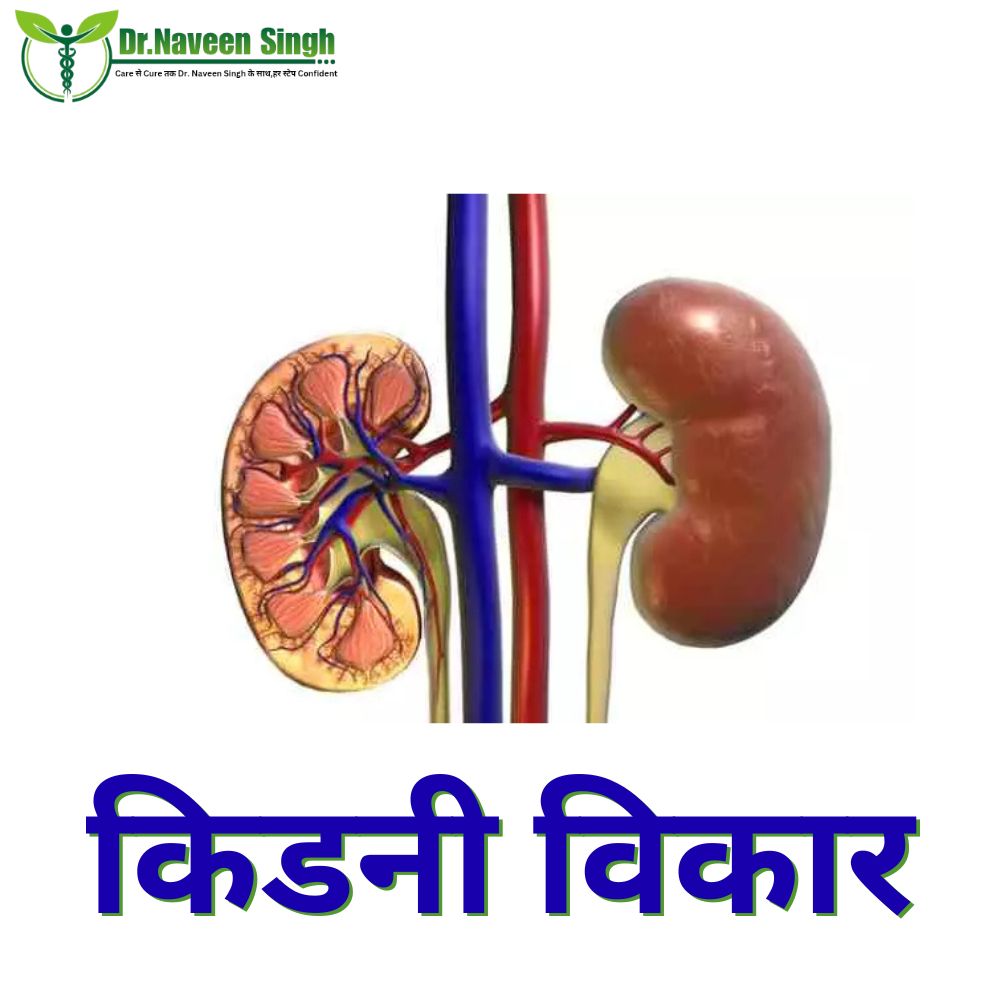 किडनी विकार