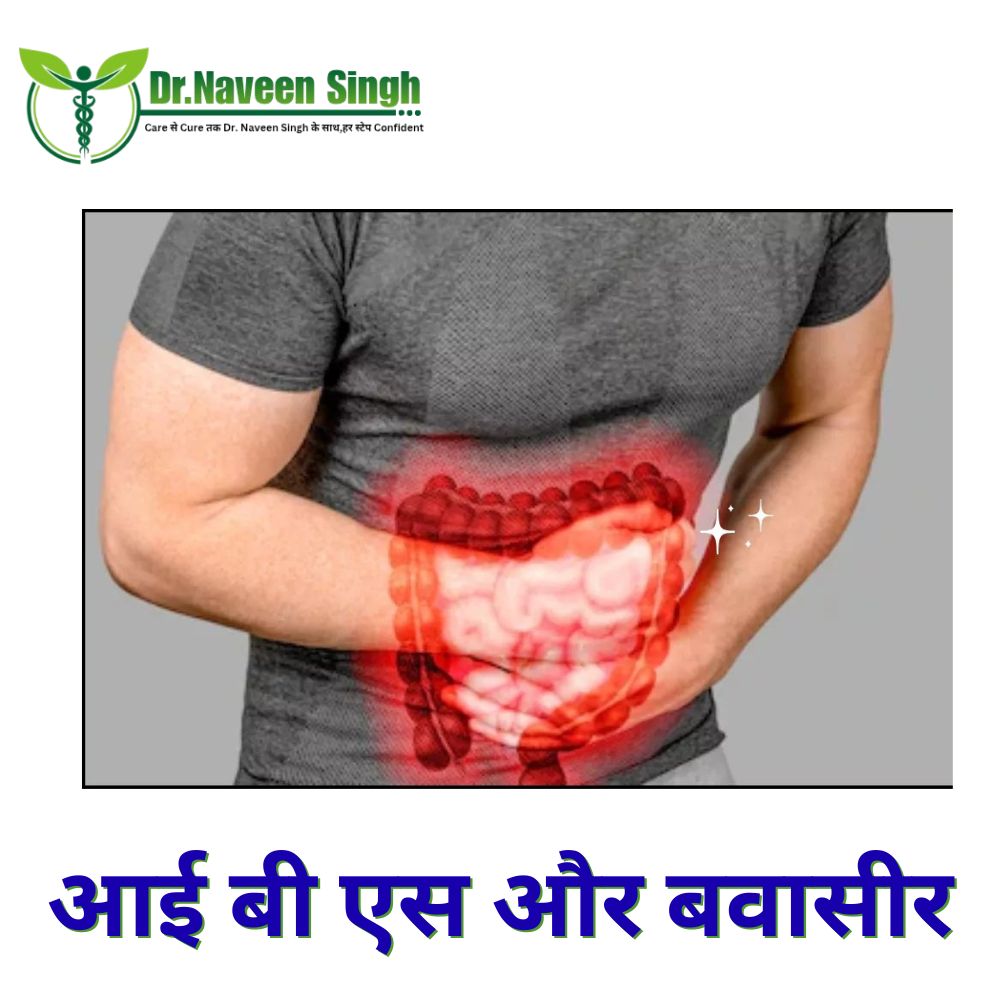 आई.बी.एस. और बवासीर